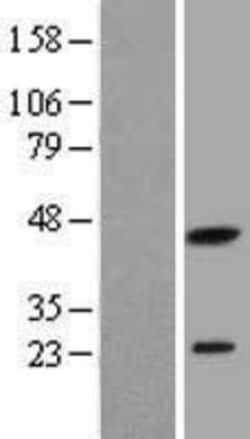Novus Biologicals&trade;&nbsp;PXMP2 Overexpression Lysate