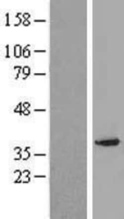 Novus Biologicals™ PXMP3 Overexpression Lysate