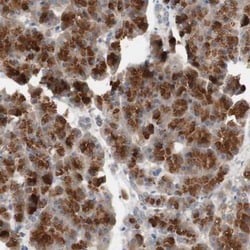 PXMP3 Antibody, Novus Biologicals 0.1mL; Unlabeled:Antibodies, Polyclonal