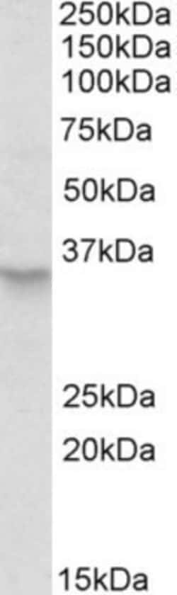 PXMP3 Antibody, Novus Biologicals 0.1mg; Unlabeled:Antibodies, Polyclonal