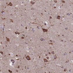 PYCR1 Antibody, Novus Biologicals:Antibodies:Primary Antibodies