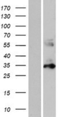 Novus Biologicals&trade;&nbsp;PYCR1 Overexpression Lysate