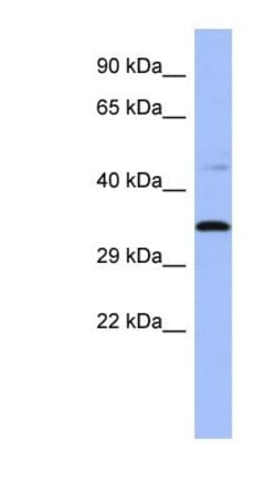 PYCR1 Antibody, Novus Biologicals 20&mu;L; Unlabeled:Antibodies, Polyclonal