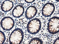 PYCR2 Antibody (OTI3D1), Novus Biologicals 0.1mL; Unlabeled:Antibodies,