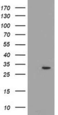 PYCR2 Antibody (OTI3D1), Novus Biologicals 0.1mL; Unlabeled:Antibodies,