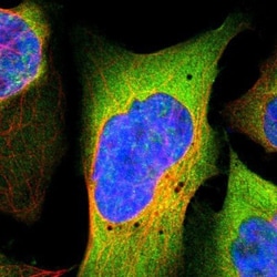 PYGL Antibody, Novus Biologicals 0.1mL; Unlabeled:Antibodies, Polyclonal