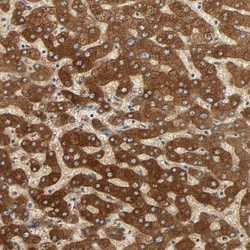 PYGL Antibody, Novus Biologicals:Antibodies:Primary Antibodies