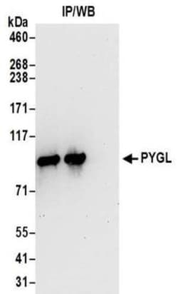 PYGL Antibody, Novus Biologicals 0.1mg; Unlabeled:Antibodies, Polyclonal