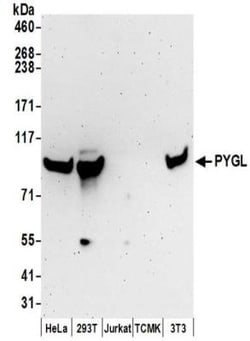 PYGL Antibody, Novus Biologicals 0.1mg; Unlabeled:Antibodies, Polyclonal