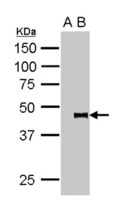 Pygopus-2 Antibody, Novus Biologicals 0.1mL; Unlabeled:Antibodies, Polyclonal