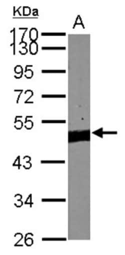 Pygopus-2 Antibody, Novus Biologicals 0.1mL; Unlabeled:Antibodies, Polyclonal