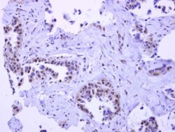 Pygopus-2 Antibody, Novus Biologicals 0.1mL; Unlabeled:Antibodies, Polyclonal