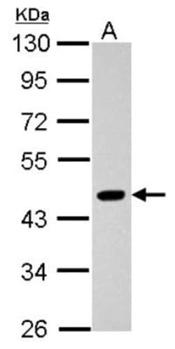 Pygopus-2 Antibody, Novus Biologicals 0.1mL; Unlabeled:Antibodies, Polyclonal