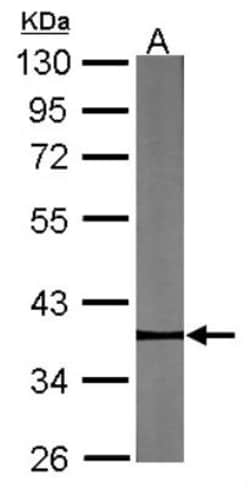 Pygopus-2 Antibody, Novus Biologicals 0.1mL; Unlabeled:Antibodies, Polyclonal