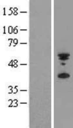 Novus Biologicals&trade;&nbsp;PYHIN1 Overexpression Lysate