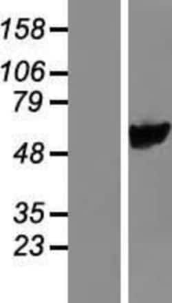 Novus Biologicals&trade;&nbsp;PYROXD1 Overexpression Lysate