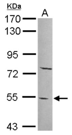 PYROXD2 Antibody, Novus Biologicals 0.1mL; Unlabeled:Antibodies, Polyclonal