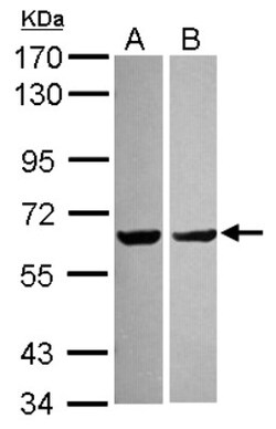 PYROXD2 Antibody, Novus Biologicals 0.1mL; Unlabeled:Antibodies, Polyclonal