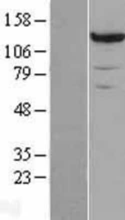 Novus Biologicals&trade;&nbsp;Pyruvate Carboxylase Overexpression Lysate
