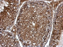Pyruvate Dehydrogenase E1 beta subunit Antibody, Novus Biologicals 0.1mL;
