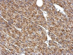 Pyruvate Dehydrogenase E1 beta subunit Antibody, Novus Biologicals 0.1mL;