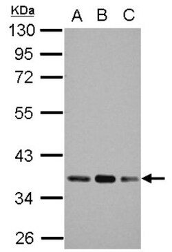 Pyruvate Dehydrogenase E1 beta subunit Antibody, Novus Biologicals 0.1mL;