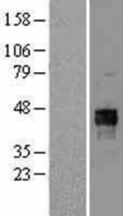 Novus Biologicals&trade;&nbsp;Pyruvate Dehydrogenase E1-alpha subunit Overexpression Lysate