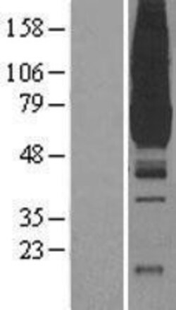 Novus Biologicals™ PKLR Overexpression Lysate