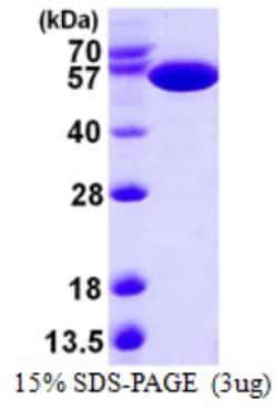 Novus Biologicals&trade;&nbsp;Recombinant E. coli PKLR His Protein