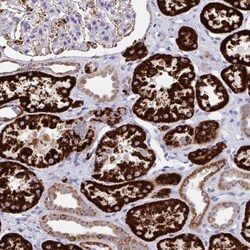 Pyruvate Carboxylase Antibody, Novus Biologicals 0.1mL; Unlabeled:Antibodies,