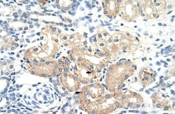 Pyruvate Dehydrogenase E2 Antibody, Novus Biologicals 0.1mg; Unlabeled:Antibodies,