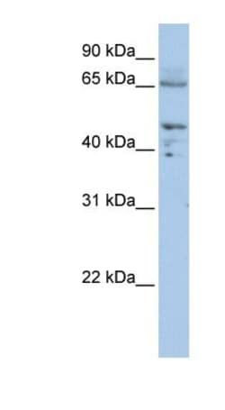 Pyruvate Dehydrogenase E2 Antibody, Novus Biologicals 100&mu;L; Unlabeled:Antibodies,