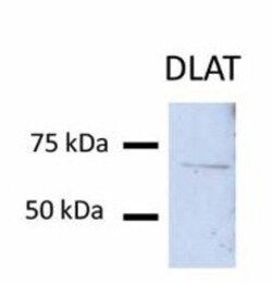 Pyruvate Dehydrogenase E2 Antibody, Novus Biologicals 0.1mg; Unlabeled:Antibodies,