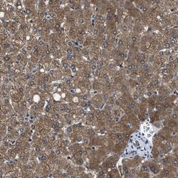 Pyruvate Dehydrogenase Phosphatase/PDP1/PPM2C Antibody, Novus Biologicals