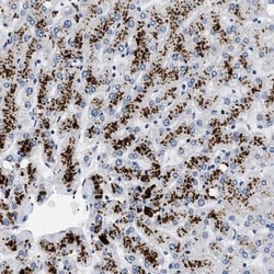 Pyruvate Dehydrogenase Phosphatase/PDP1/PPM2C Antibody, Novus Biologicals