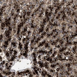 Pyruvate Dehydrogenase Phosphatase/PDP1/PPM2C Antibody, Novus Biologicals