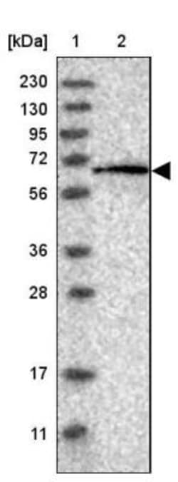 Pyruvate Dehydrogenase Phosphatase/PDP1/PPM2C Antibody, Novus Biologicals
