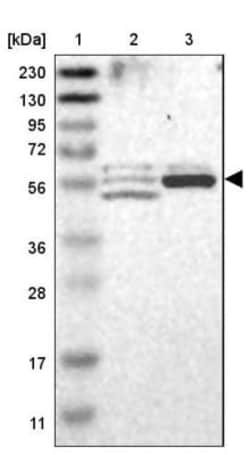 Pyruvate Dehydrogenase Phosphatase/PDP1/PPM2C Antibody, Novus Biologicals