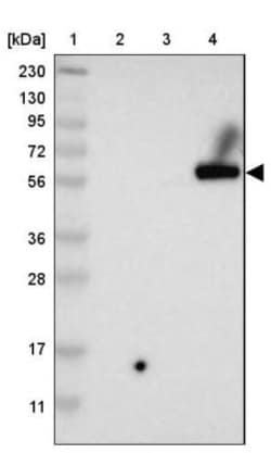 Pyruvate Dehydrogenase Phosphatase/PDP1/PPM2C Antibody, Novus Biologicals