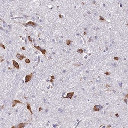 QARS Antibody, Novus Biologicals 0.1mL; Unlabeled:Antibodies, Polyclonal