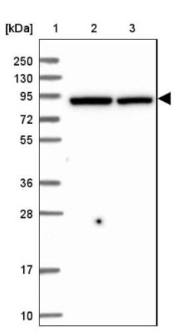 QARS Antibody, Novus Biologicals 0.1mL; Unlabeled:Antibodies, Polyclonal