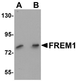 QBRICK/FREM1 Antibody - BSA Free, Novus Biologicals:Antibodies:Primary