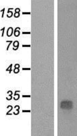 Novus Biologicals&trade;&nbsp;QDPR Overexpression Lysate