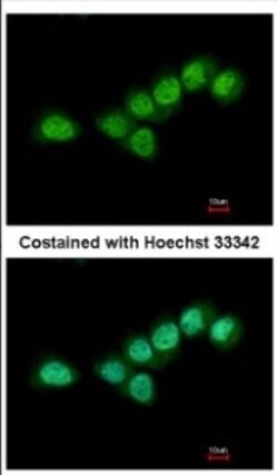 QKI/Quaking Antibody, Novus Biologicals 0.1 mL | Buy Online | Novus Biologicals | Fisher Scientific