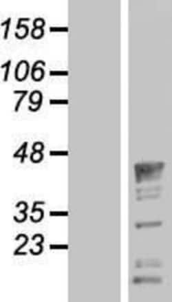 Novus Biologicals&trade;&nbsp;QKI/Quaking Overexpression Lysate