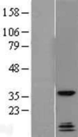 Novus Biologicals™ QKI/Quaking Overexpression Lysate
