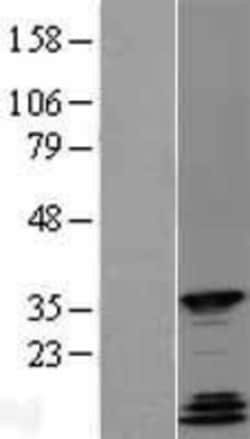 Novus Biologicals&trade;&nbsp;QKI/Quaking Overexpression Lysate