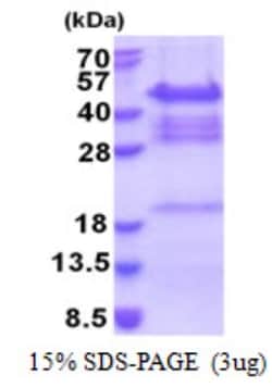 Novus Biologicals&trade;&nbsp;Recombinant Human QKI/Quaking His Protein