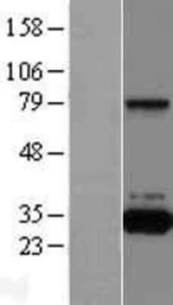 Novus Biologicals&trade;&nbsp;QPRT Overexpression Lysate