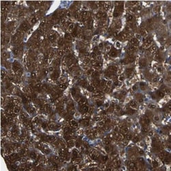 QPRT Antibody, Novus Biologicals 0.1mL; Unlabeled:Antibodies, Polyclonal